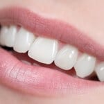DtGV: Die besten Zahnzusatzversicherungen im Test